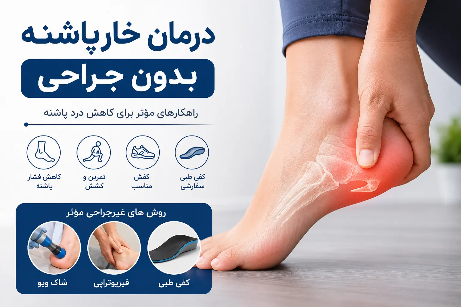 درمان خارپاشنه بدون جراحی با کفی طبی، تمرین و شاک‌ویو